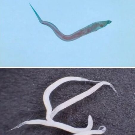 Types de parasites dans le corps humain