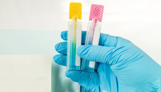 Méthodes de diagnostic parasites